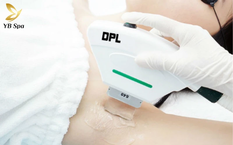 Đánh bại mọi giới hạn của IPL truyền thống, DPL giúp rút ngắn đáng kể thời gian liệu trình và duy trì kết quả mịn màng bền lâu