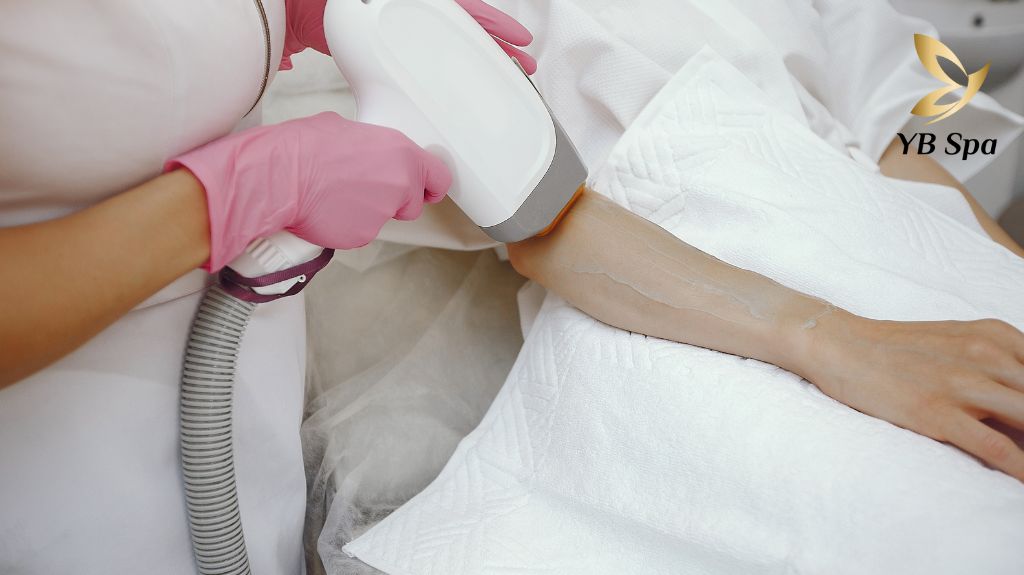 Giới thiệu công nghệ triệt lông âm 5 độ công nghệ mới của YB Spa 20 Cong Nghe Triet Long Am 5 Do 1