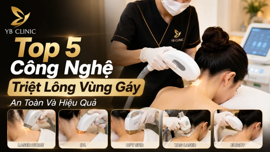 Top 5 Công Nghệ Triệt Lông Vùng Gáy An Toàn Và Hiệu Quả