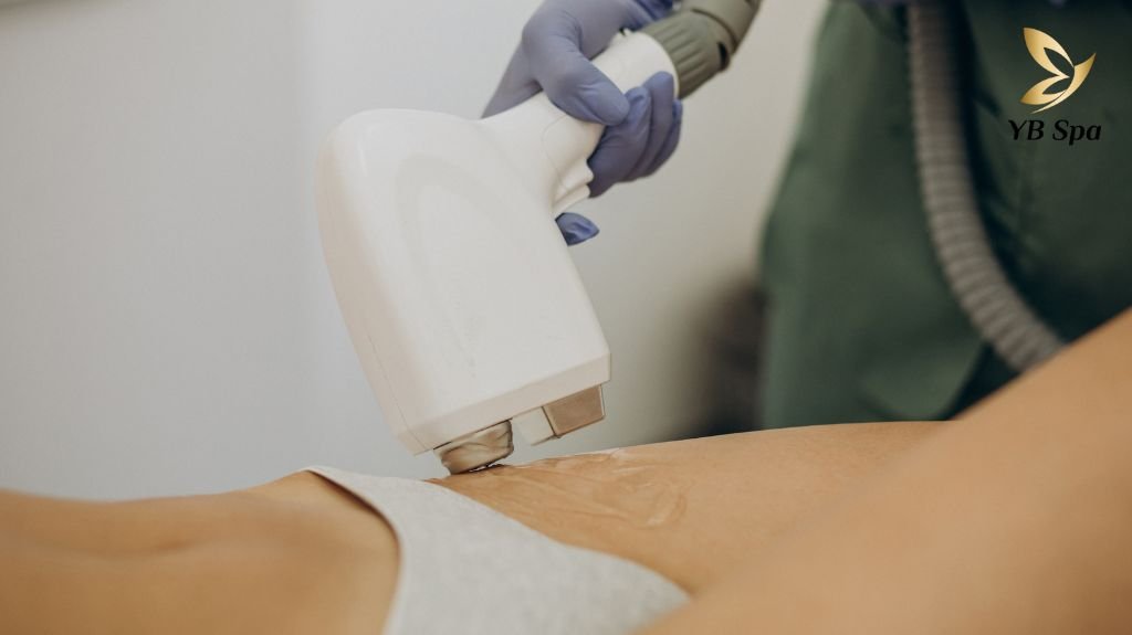 Tìm hiểu công nghệ triệt lông IPL SHR ICE 2+ tại YB Spa 22 Cong Nghe Triet Long Ipl Shr Ice 2 3