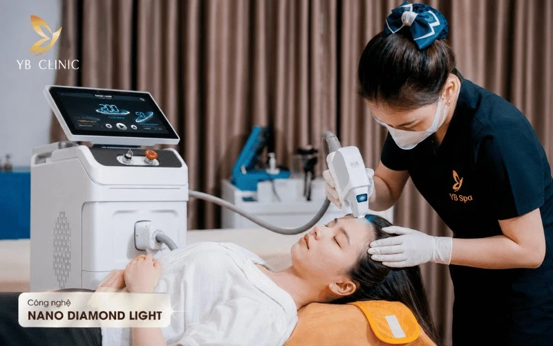 Triệt đường chân tóc tại YB Clinic với Nano Diamond Light giúp xử lý tóc con gọn gàng, êm ái chỉ sau 5–10 phút mỗi buổi.