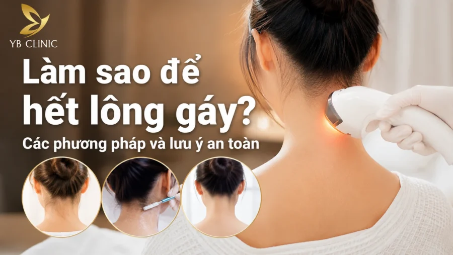 Làm sao để hết lông gáy? Các phương pháp và lưu ý an toàn