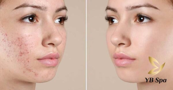 Da Mun Co Nen Triet Long Mat Khong 2