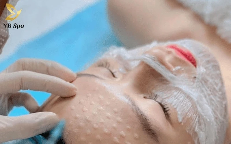 Tiêm meso cho da mụn hoàn toàn khả thi nếu được bác sĩ trực tiếp thăm khám và chỉ định phác đồ phù hợp