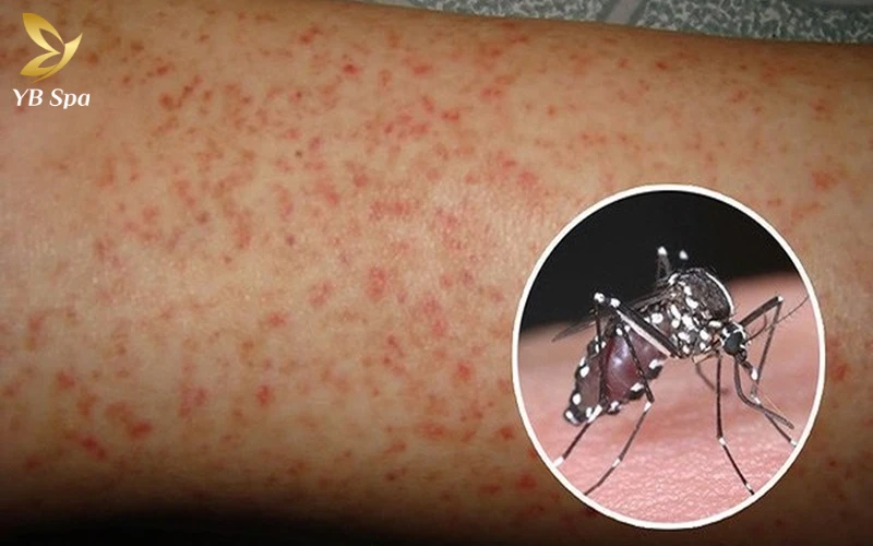 Phân biệt với các tổn thương da khác