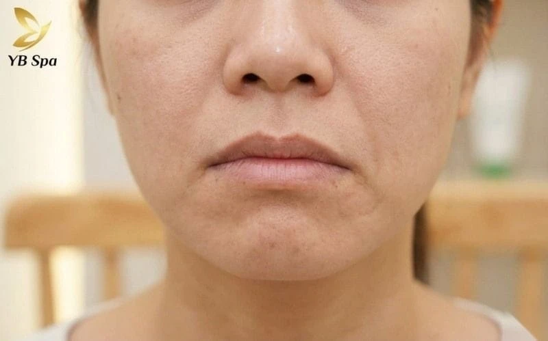 Dạng miệng cá chép môi mỏng thể hiện khả năng giao tiếp không tốt, dễ gây hiểu lầm.