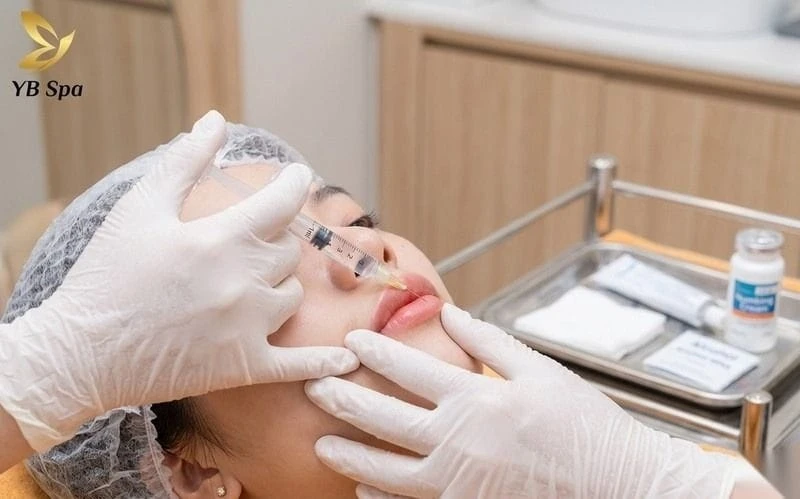 Tiêm filler là phương pháp thẩm mỹ phổ biến giúp tạo dáng môi trái đào đẹp tự nhiên.