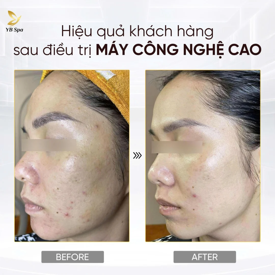 Trang chủ 93 Trang chủ