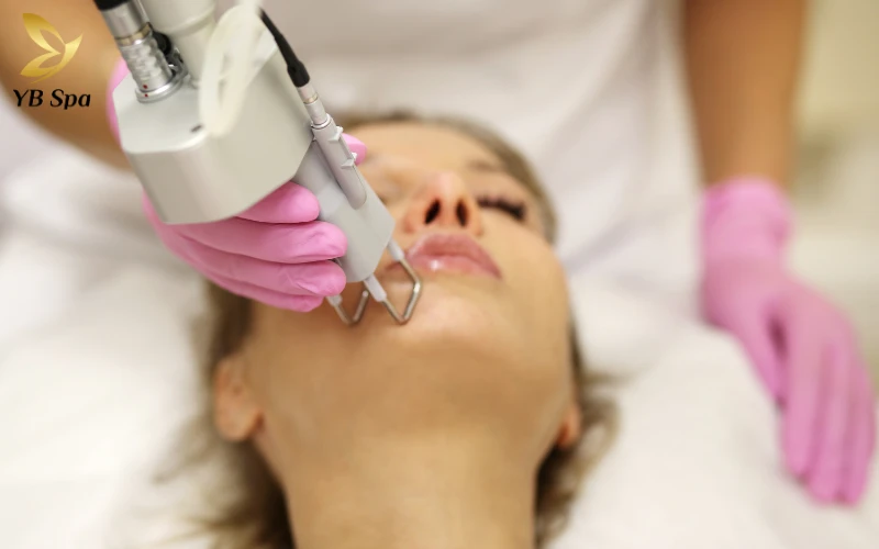 Công nghệ Density trị nám có được không? 25 Công nghệ laser trị nám chuyên sâu