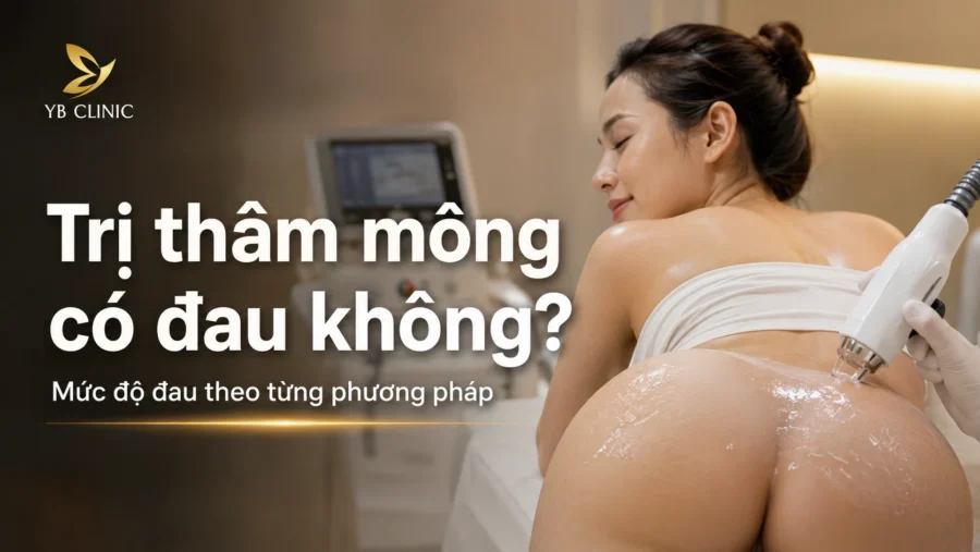 Trị thâm mông có đau không? Mức độ đau theo từng phương pháp