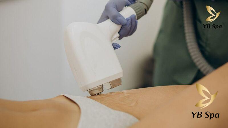 Top 10 Địa Chỉ Triệt Lông Body Uy Tín TPHCM 31 Triệt lông Body uy tín (Nguồn: YB Spa)