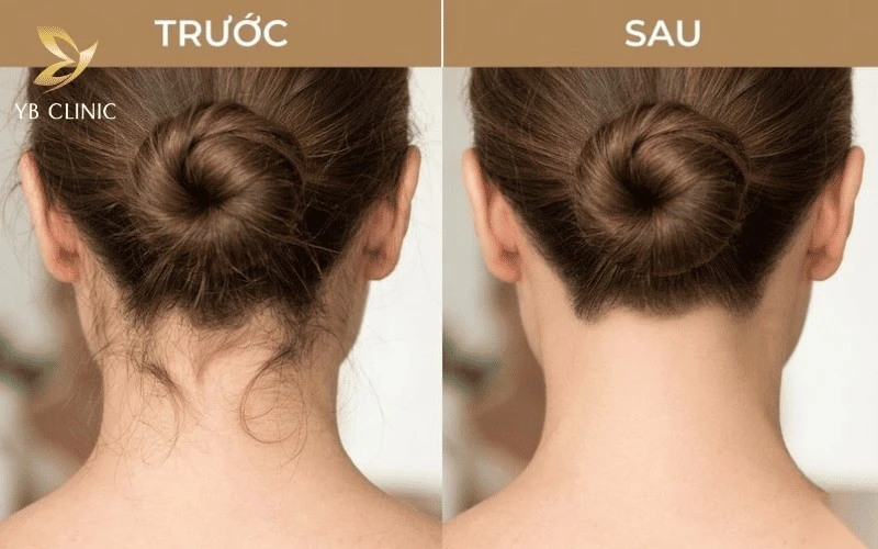 Điều Gì Khiến Một Kiểu Búi Tóc Nhìn Sang Hơn? Bí Quyết Từ Vùng Gáy 11 Sự khác biệt rõ rệt giữa đường gáy lộn xộn và gáy sạch sẽ khi búi tóc.