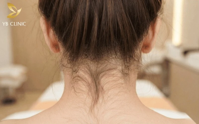 Điều Gì Tạo Nên Vẻ Đẹp Của Phần Cổ Gáy? Tiêu Chí Và Phương Pháp Chăm Sóc 12 Tóc con và lông gáy mọc dày, lòa xòa khiến vùng cổ có cảm giác bị ngắn lại.