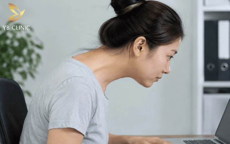 Điều Gì Tạo Nên Vẻ Đẹp Của Phần Cổ Gáy? Tiêu Chí Và Phương Pháp Chăm Sóc 13 Tư thế cổ rùa gây gù khiến đầu và cổ bị đưa ra phía trước, làm mất cân đối vùng cổ gáy, tạo cảm giác kém thanh thoát và ảnh hưởng đến tổng thể vóc dáng.