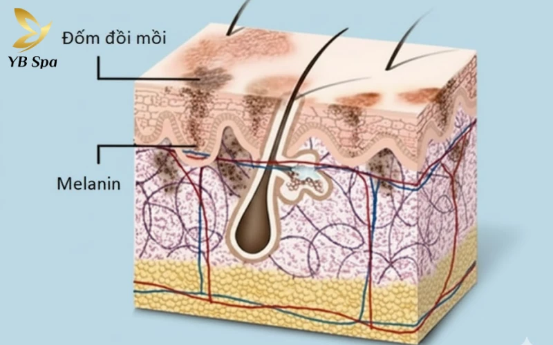 Đồi mồi là gì?