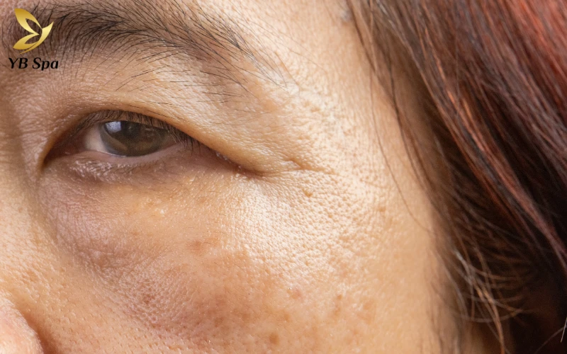 Quá trình lão hóa tự nhiên