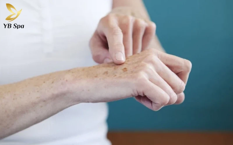 Các biểu hiện điển hình