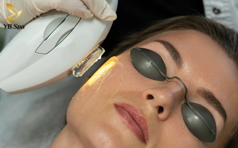 Liệu Trình IPL (Ánh sáng xung cường độ cao)