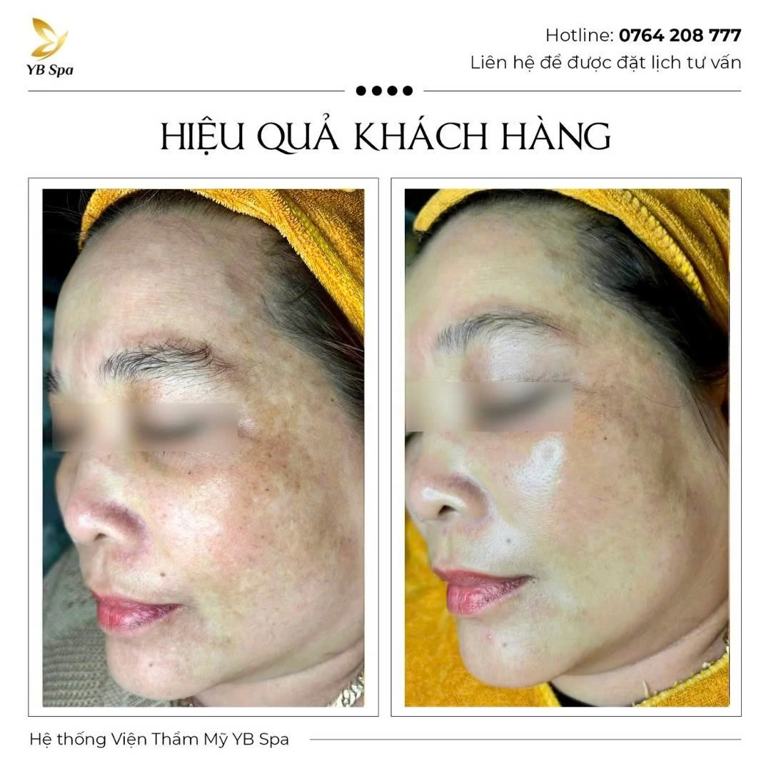 Trang chủ 55 Trang chủ