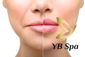 Cẩn trọng với những biến chứng filler rởm