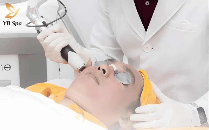 Giá Điều Trị Mao Mạch Bằng Laser Chrome 