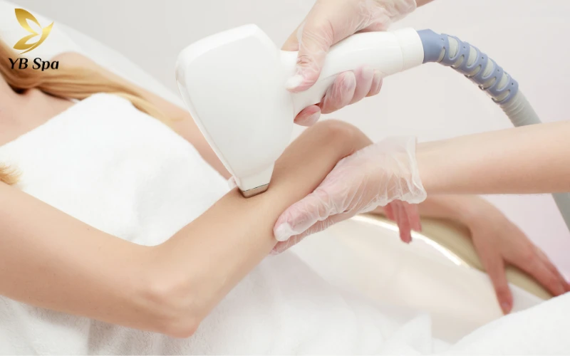 Công nghệ triệt lông Diode Laser là gì?