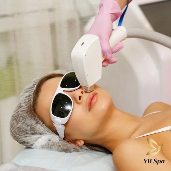 Vậy giá triệt lông mặt vĩnh viễn bao nhiêu tiền? (Nguồn: YB Spa)