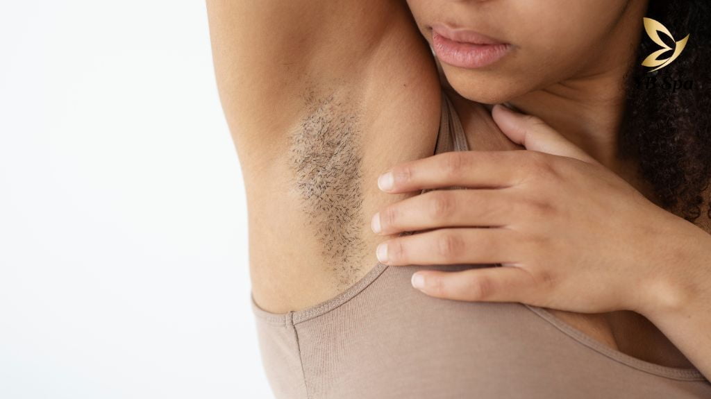 Giá triệt lông nách YB Spa bao nhiêu tiền? Có bảo hành không? 19 Giá Triệt Lông Nách