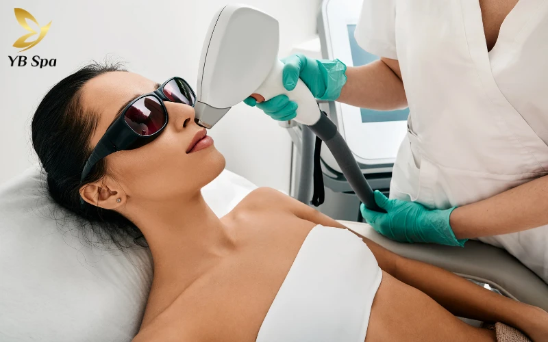 Giá triệt ria mép bao nhiêu tiền