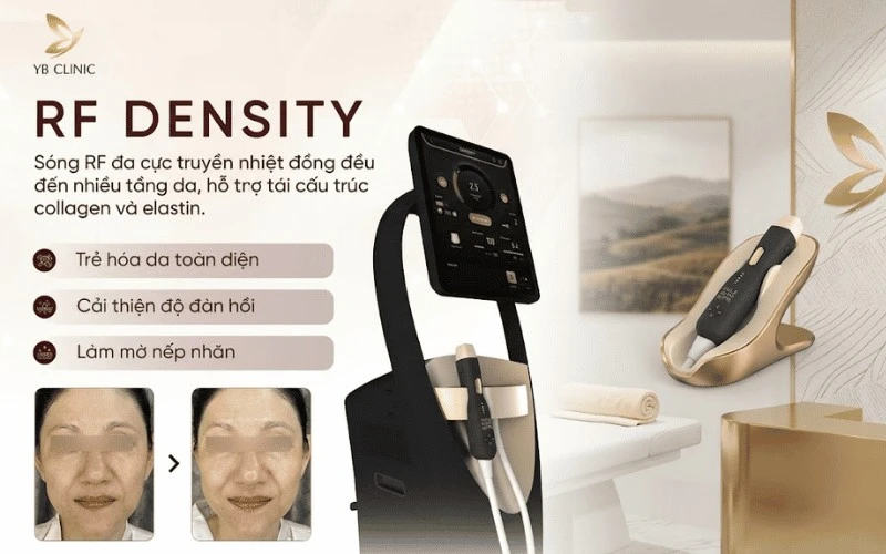 Công nghệ nâng cơ, trẻ hóa da toàn diện RF Density tại YB Clinic giúp cải thiện độ đàn hồi, xóa mờ nếp nhăn và phục hồi cấu trúc collagen sâu bên trong.