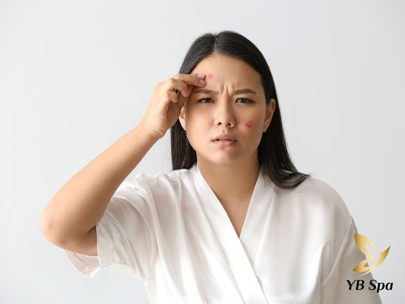 hút mủ mụn nhọt nhanh nhất