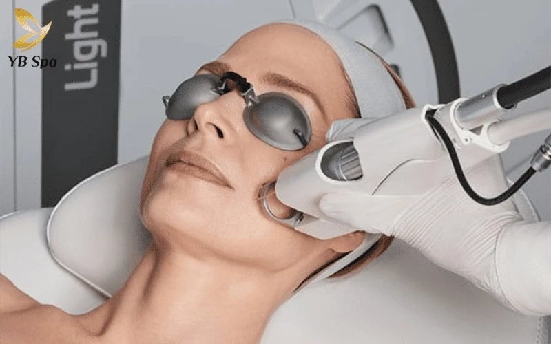 Điều trị mao mạch Tạm biệt các mạch máu li ti nhờ cơ chế đông co thành mạch lỗi chuyên sâu của giải pháp Laser Chrome thế hệ mới