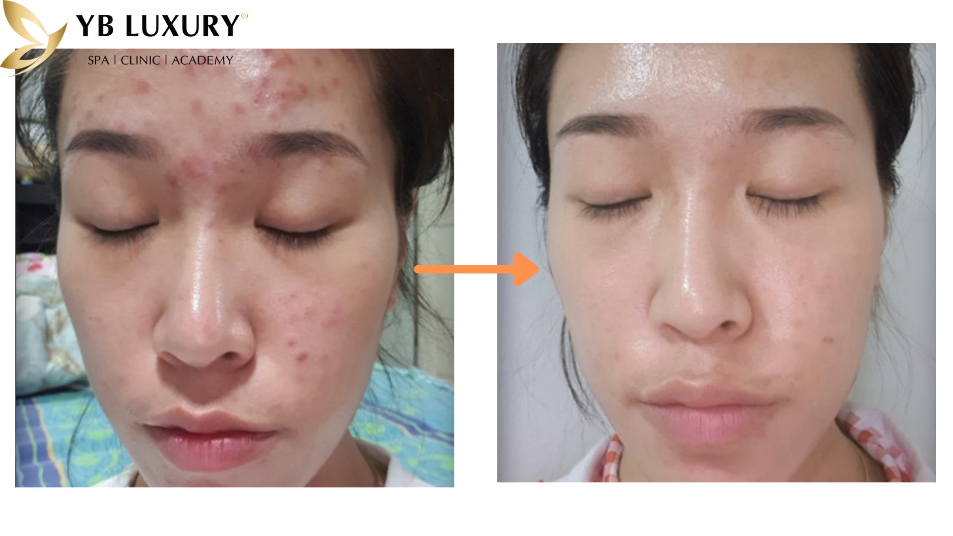 Ket Qua Tri Mun Trung Ca