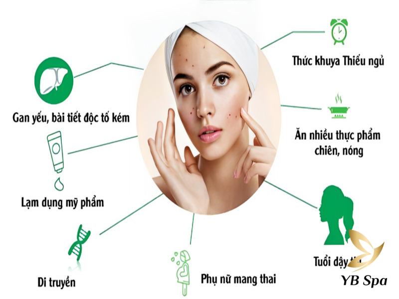 Không nặn mụn có tự hết không? Cách nặn và điều trị mụn chuẩn 22 Mụn là những nốt sưng đỏ chứa mủ có thể bị đau do viêm thậm chí là ngứa rát.