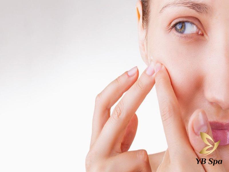 Không nặn mụn có tự hết không? Cách nặn và điều trị mụn chuẩn 23 các loại mụn đều có thể tự hết mà không cần nặn