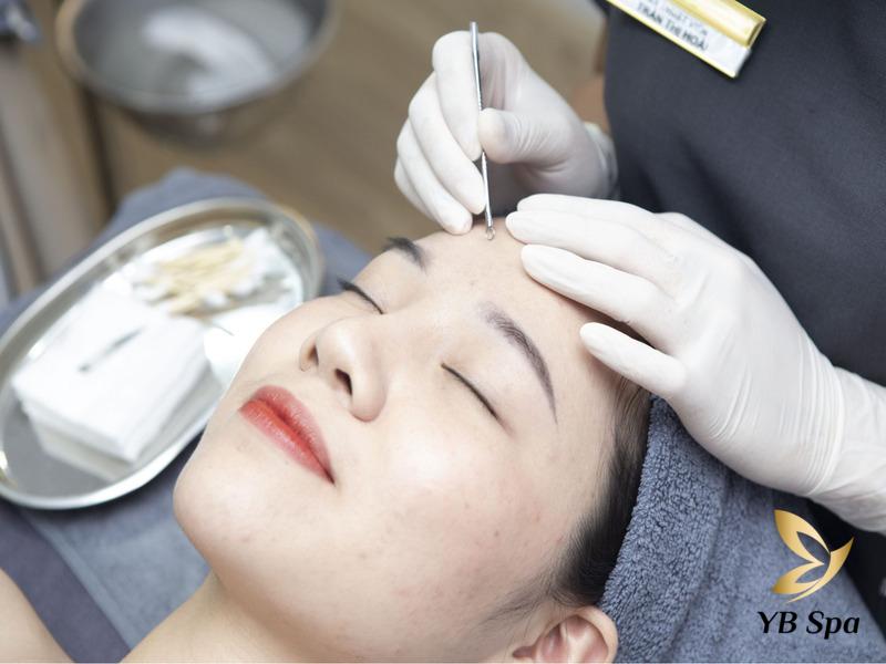 Không nặn mụn có tự hết không? Cách nặn và điều trị mụn chuẩn 29 Không nặn mụn có tự hết không? Cách nặn và điều trị mụn chuẩn
