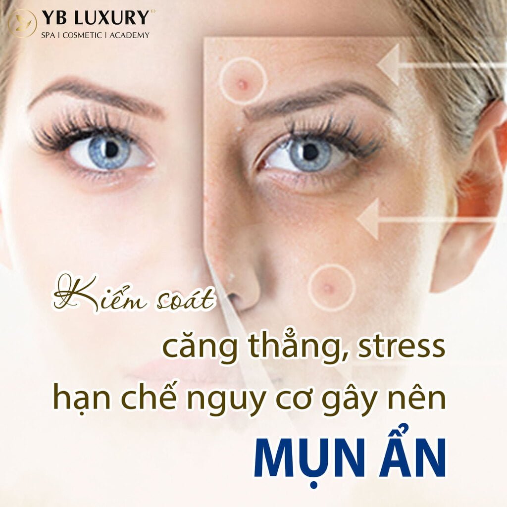 Kiem Soat Cang Thang Stress Han Che Nguy Co Gay Nen Mun An