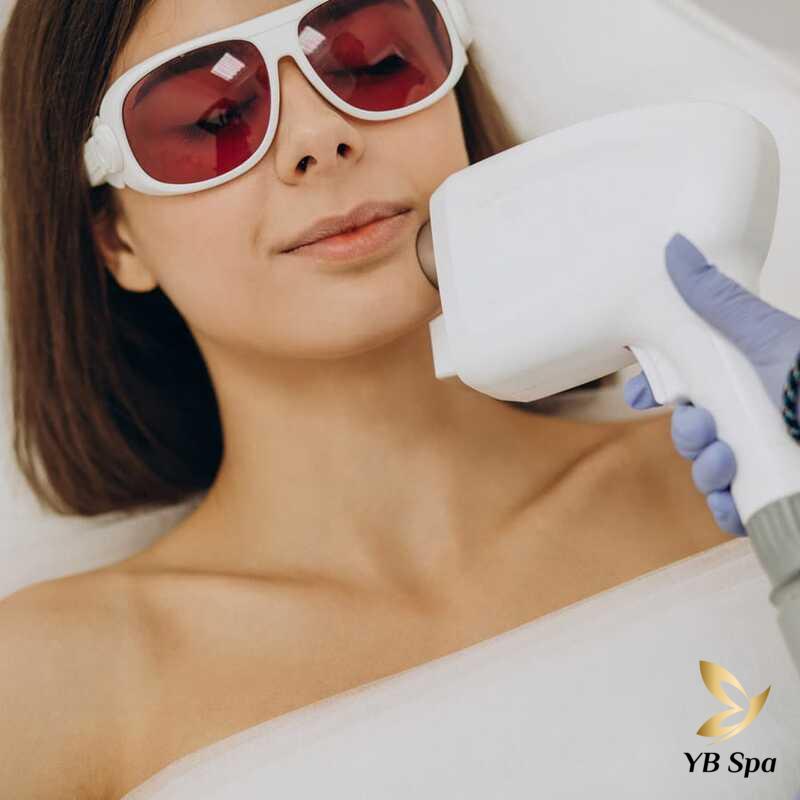 Triệt lông vĩnh viễn (Nguồn: Internet)