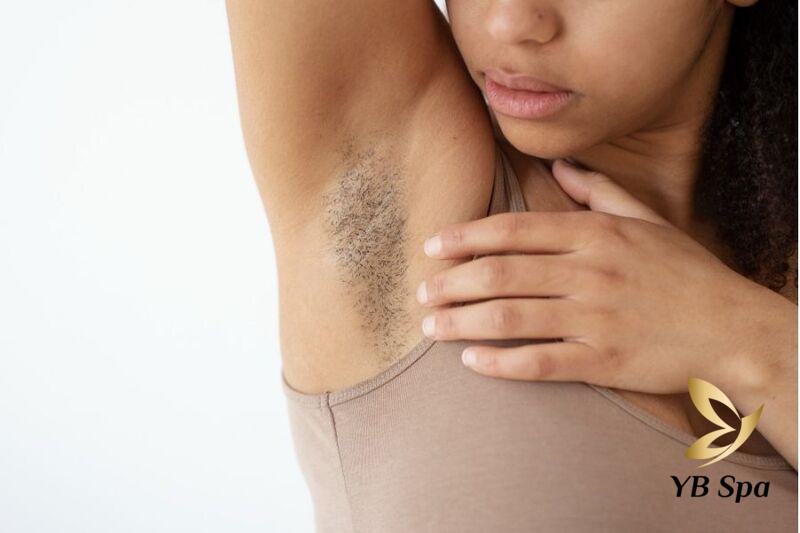 Những Kinh Nghiệm Triệt Lông Nách Tại Spa Cho Người Mới 23 Những kinh nghiệm triệt lông nách tại Spa cho người mới (Nguồn: Internet)
