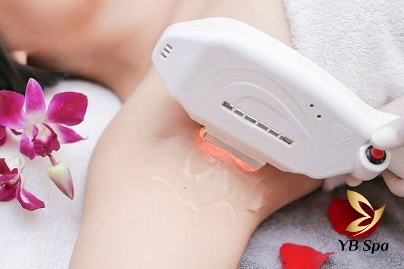 Những Kinh Nghiệm Triệt Lông Nách Tại Spa Cho Người Mới 26 Công nghệ IPL (Intense Pulsed Light) (Nguồn: Internet)