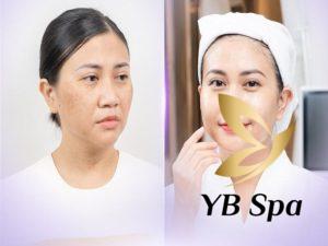 Lão hóa da là một quá trình không thể tránh khỏi do sự suy giảm collagen và tác động từ môi trường bên ngoài.