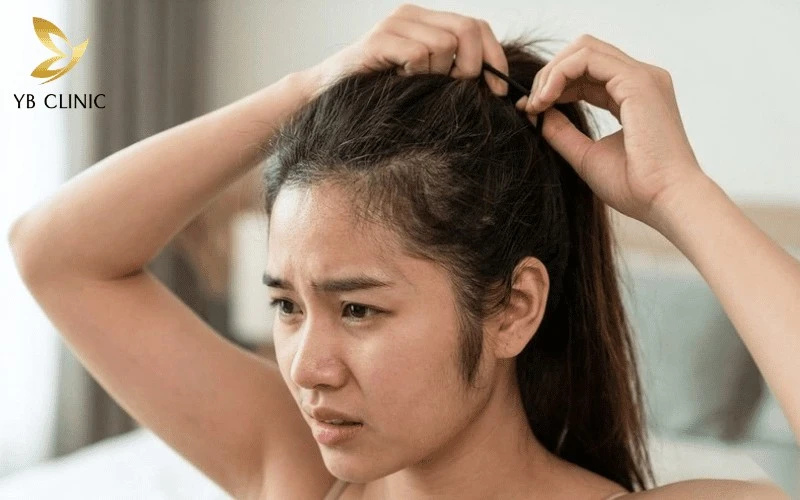 Tóc con và tóc mai quá dày dễ khiến gương mặt trông tối và mất đi nét thanh thoát.