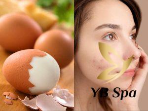 Lăn trứng gà trị mụn có hiệu quả không? Cần lưu ý gì?