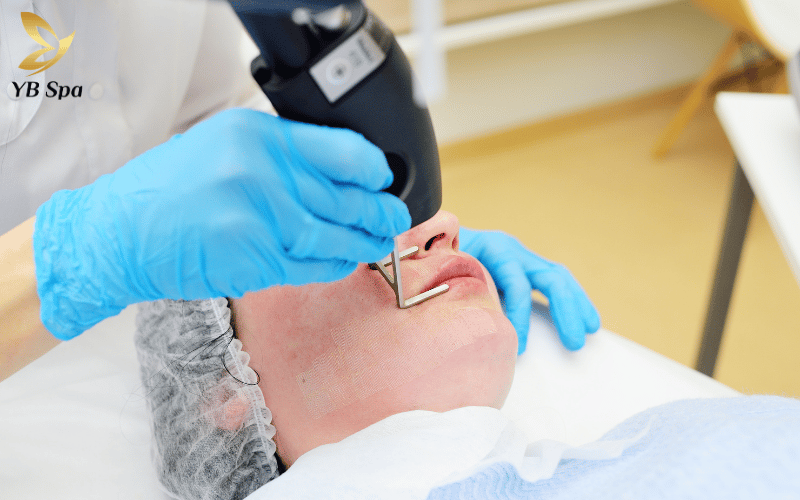 Laser là giải pháp tối ưu giúp đánh bay thâm mụn tận gốc mà các loại kem bôi thông thường khó lòng thực hiện được