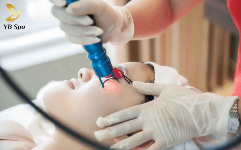 Laser trị thâm mụn có tốt không? Hoạt động như thế nào? 11 Khám phá sức mạnh "3 trong 1" của laser: Phân rã melanin, giảm thâm đỏ và tăng sinh collagen giúp da đều màu không tì vết.