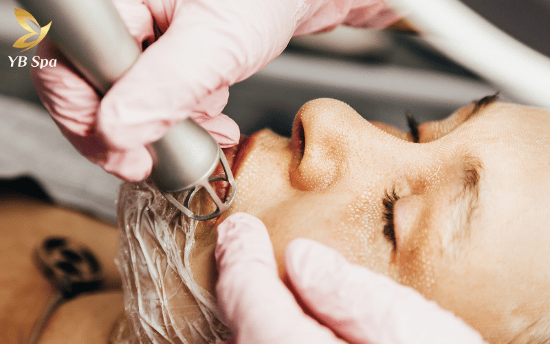 Laser trị thâm mụn có tốt không? Hoạt động như thế nào? 17 Fractional CO2 giúp cải thiện cấu trúc da từ sâu bên trong, giải quyết triệt để các khuyết điểm sau mụn cho làn da khỏe mạnh