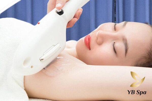 Liệu Trình Triệt Lông Vĩnh Viễn Cơ Bản Mà Bạn Cần Biết 22 Triệt lông bằng phương pháp hiện đại (Nguồn: Internet)