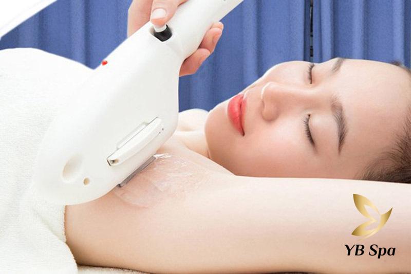 Liệu Trình Triệt Lông Vĩnh Viễn Cơ Bản Mà Bạn Cần Biết 19 Triệt lông bằng phương pháp hiện đại (Nguồn: Internet)