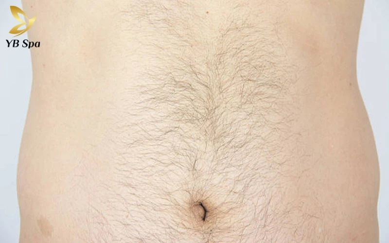 Vì sao phụ nữ có đường lông bụng? Có nguy hiểm không? 9 Hiểu rõ nguyên nhân khoa học phía sau đường lông bụng sẽ giúp phái đẹp có cách chăm sóc cơ thể đúng đắn và lựa chọn phương pháp thẩm mỹ phù hợp