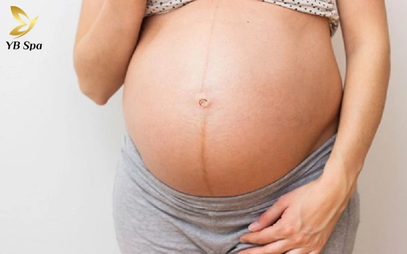 Vì sao phụ nữ có đường lông bụng? Có nguy hiểm không? 11 Sự gia tăng đột biến của các hormone nội tiết như Estrogen và Progesterone là tác nhân chính hình thành đường Linea Nigra sẫm màu ở mẹ bầu